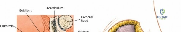 Clinical Image
