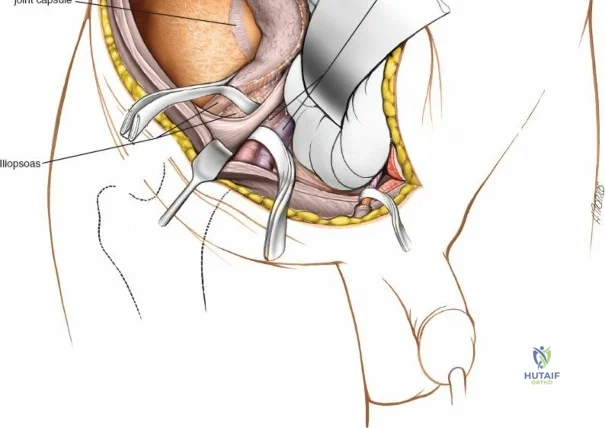 Clinical Image