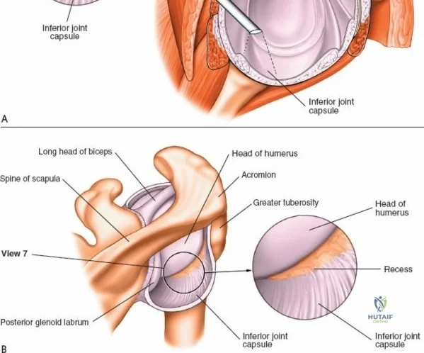 Clinical Image