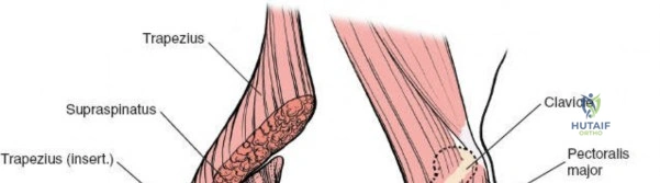 Clinical Image