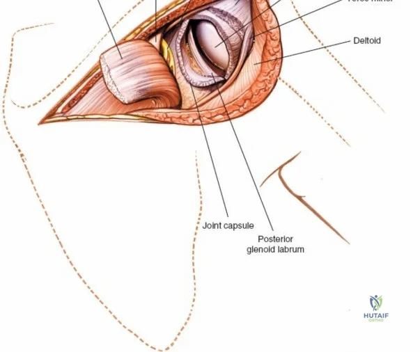 Clinical Image