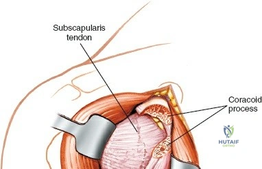 Clinical Image