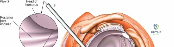 Clinical Image