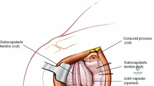 Clinical Image