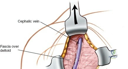 Clinical Image