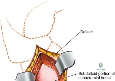 Clinical Image