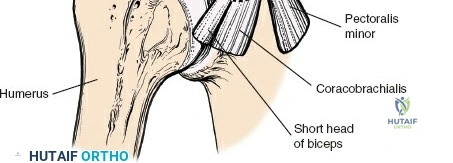 Clinical Image