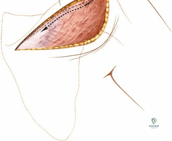 Clinical Image