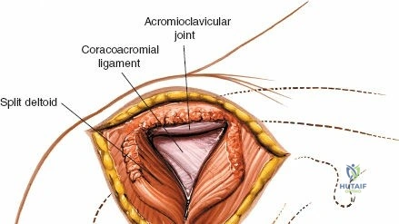 Clinical Image