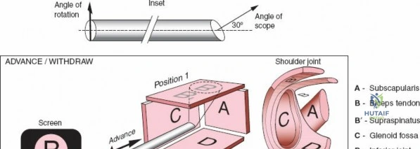 Clinical Image
