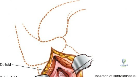 Clinical Image