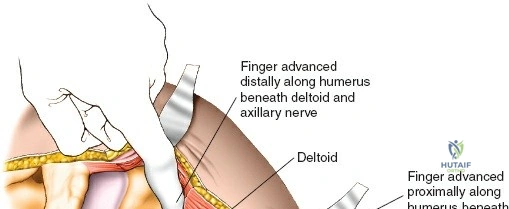 Clinical Image