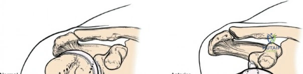 Clinical Image