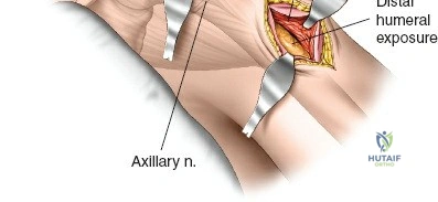 Clinical Image