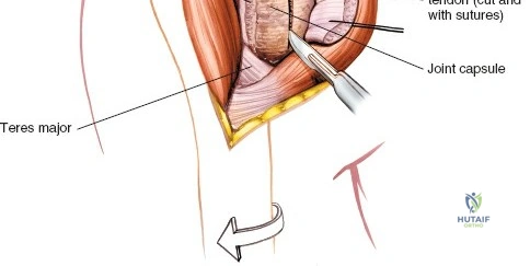 Clinical Image