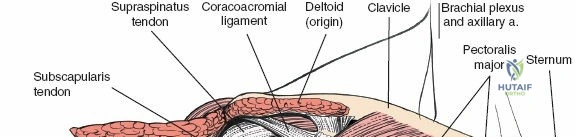 Clinical Image