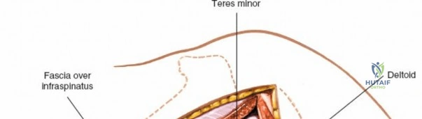 Clinical Image