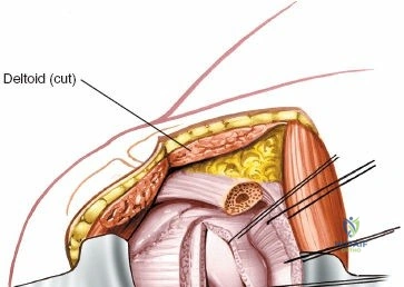 Clinical Image