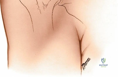 Clinical Image
