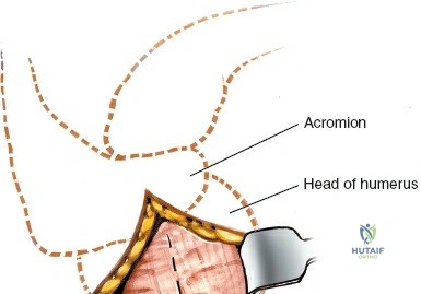 Clinical Image