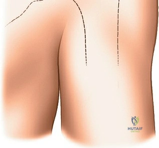Clinical Image