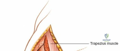 Clinical Image