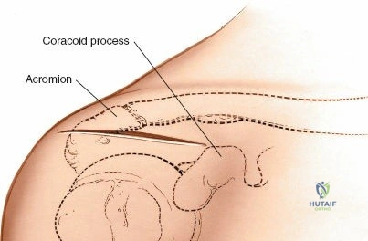 Clinical Image