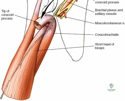 Clinical Image