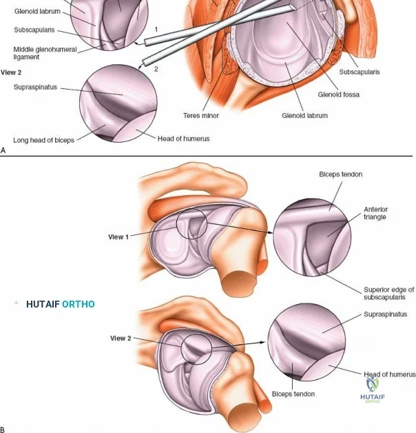 Clinical Image