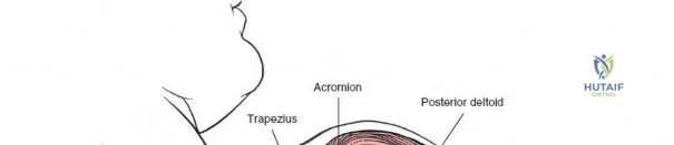 Clinical Image