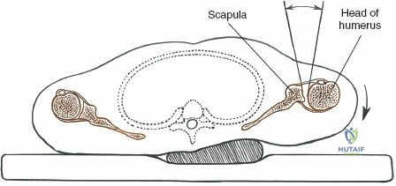 Clinical Image