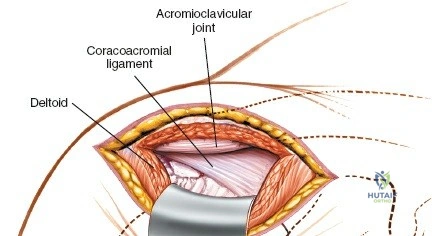 Clinical Image
