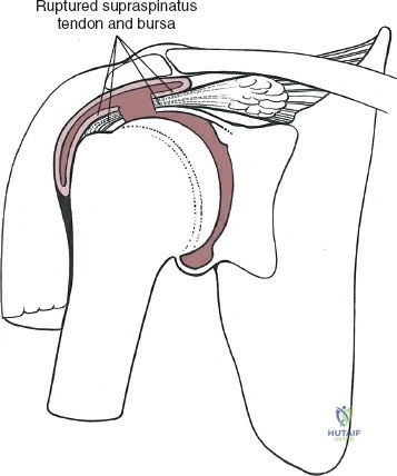 Clinical Image
