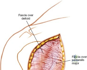 Clinical Image