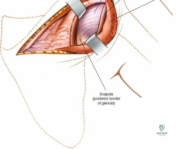 Clinical Image