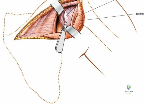 Clinical Image