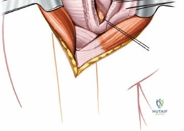 Clinical Image