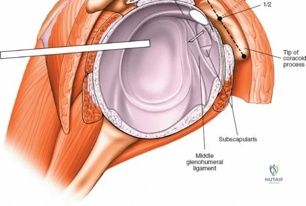 Clinical Image