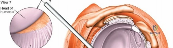 Clinical Image