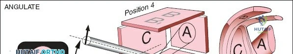 Clinical Image