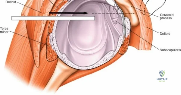 Clinical Image