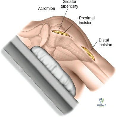 Clinical Image