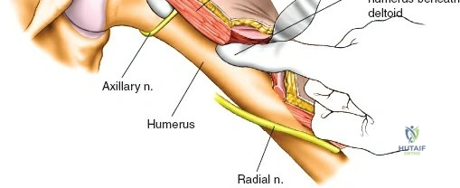 Clinical Image