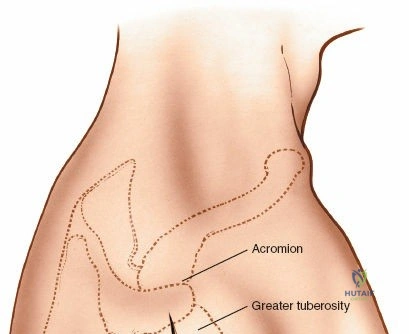 Clinical Image