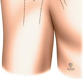 Clinical Image