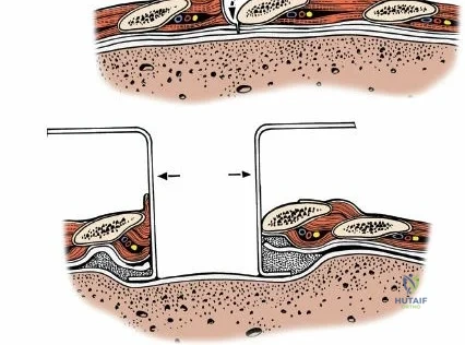 Clinical Image