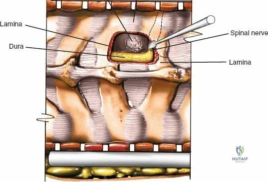 Clinical Image