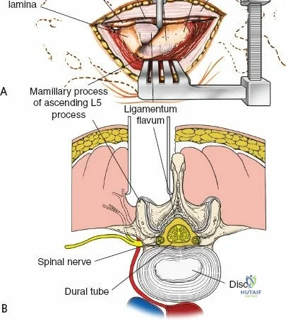 Clinical Image