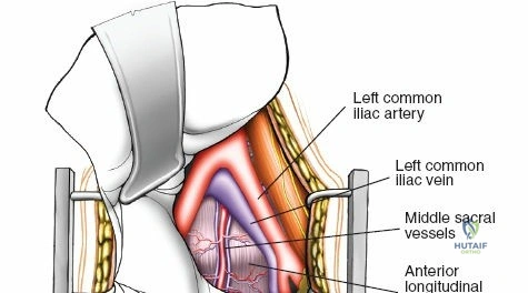 Clinical Image