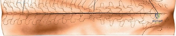 Clinical Image